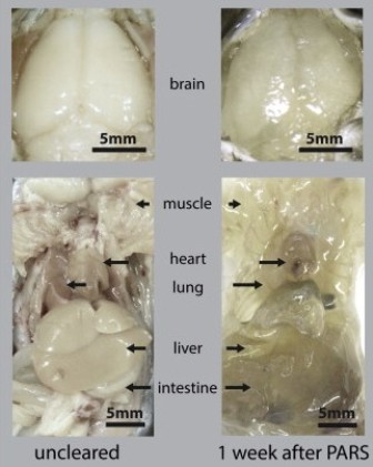 A comparison of optical transparency of mouse brains and major organs before and after PARS clearing